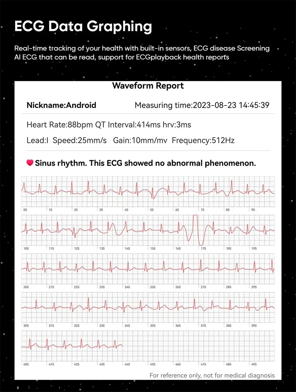 Xiaomi lipídios no sangue úrico glicose no sangue relógio inteligente masculino rastreador de fitness relógio freqüência cardíaca bluetooth chamando ecg + ppg smartwatch